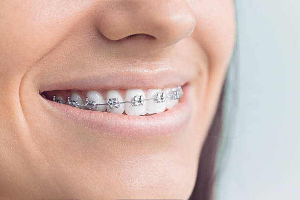 Best Traditional Braces  in East Northport, NY
